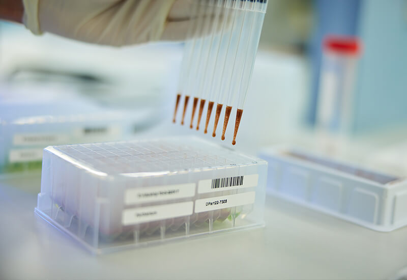 Pipettes used to prepare samples for genome complexity reduction technology DArTseq